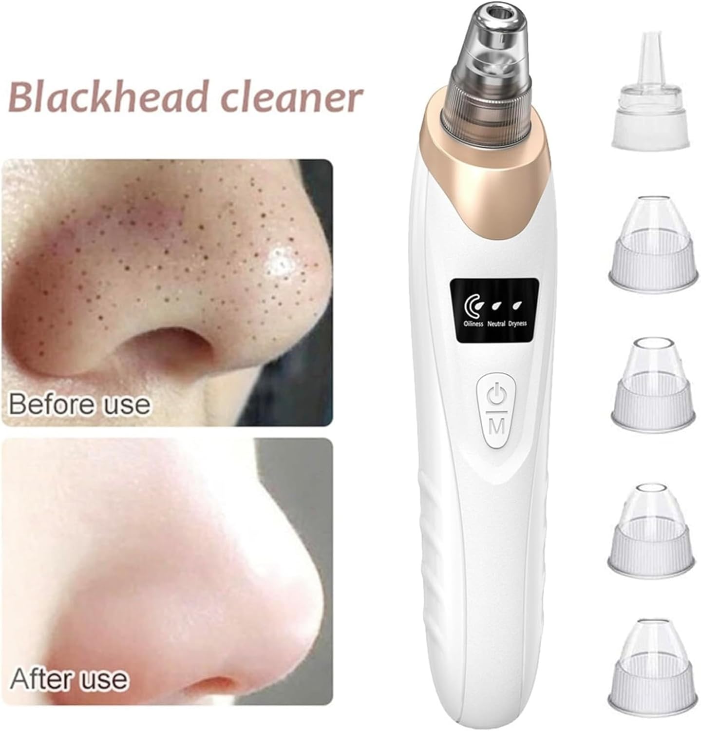 5 in 1 Electric Blackhead Acne Oil Remover Machine